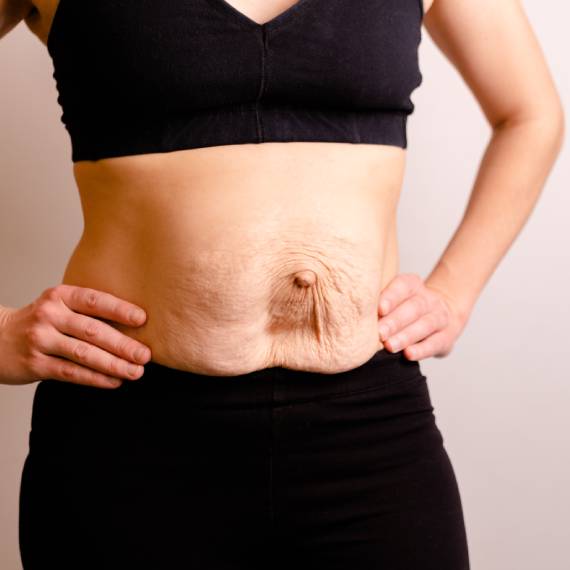 Reparación de pared abdominal