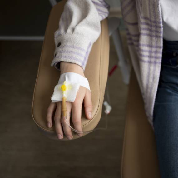 Colocación de catéter para quimioterapia